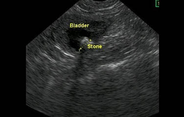 UltraSoundScan