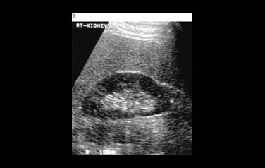 UltraSoundScan