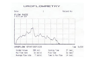 uroflow